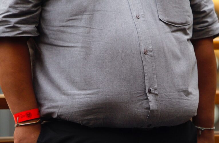 La obesidad afecta al sistema inmunitario incluso una década después de perder peso